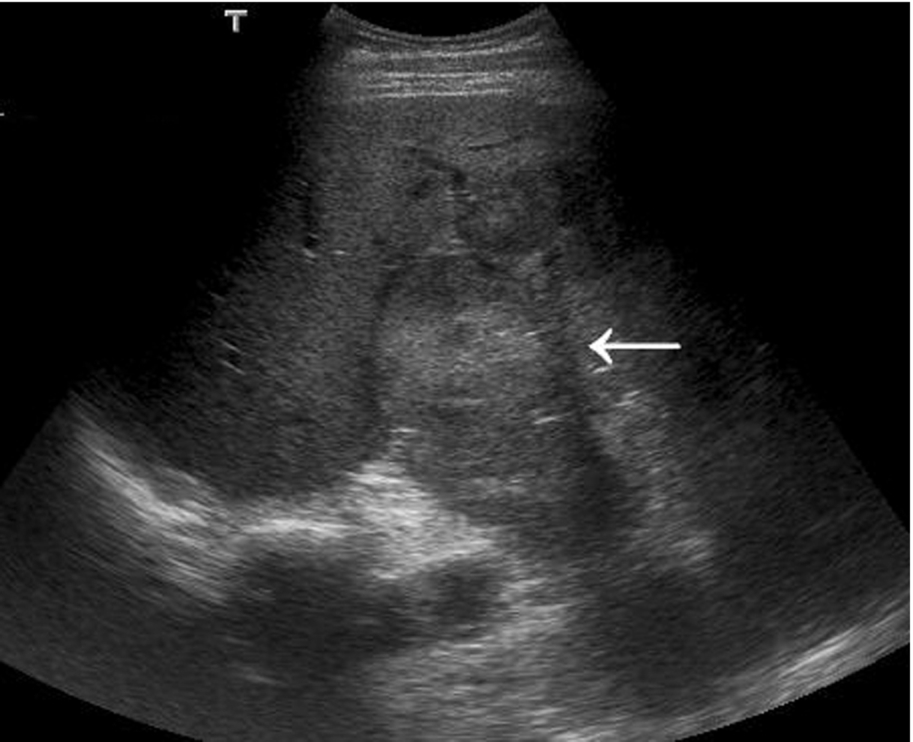 Fig. 3.61