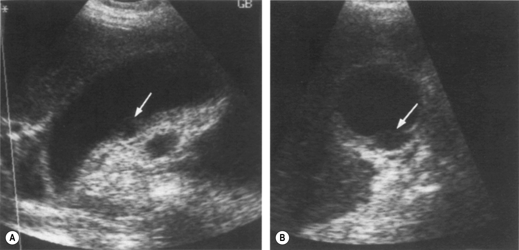 Fig. 3.62