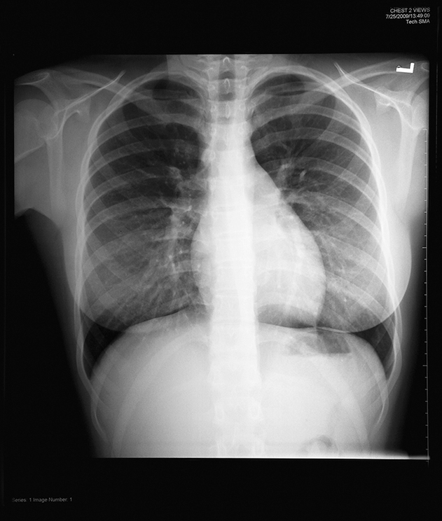A posteroanterior chest radiograph.