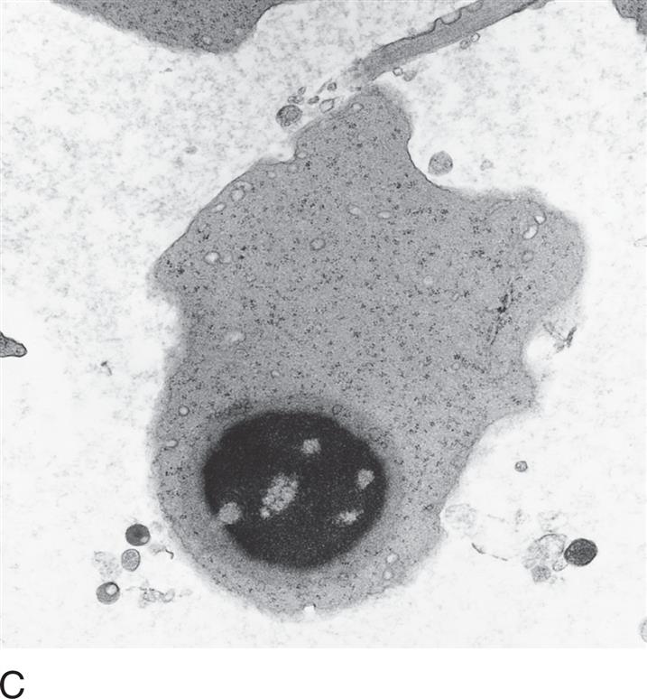 Clinical Hematology Atlas