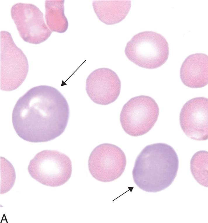 Clinical Hematology Atlas
