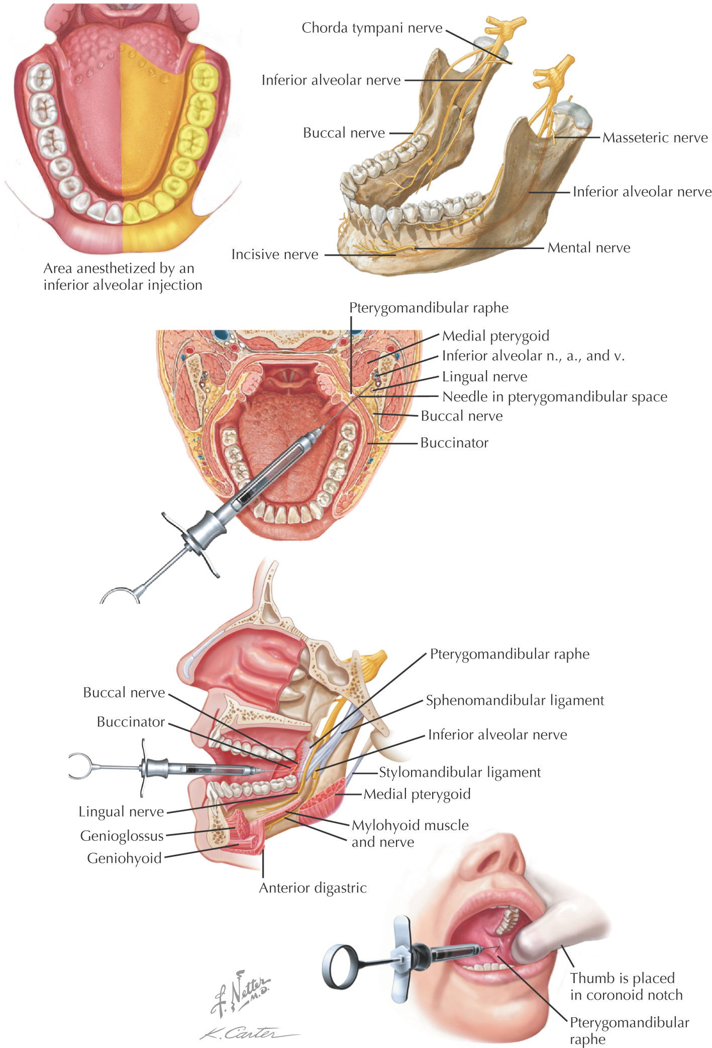 images