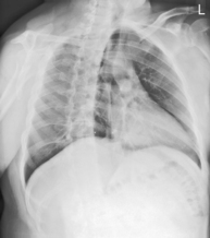 Bontrager’s HANDBOOK OF RADIOGRAPHIC POSITIONING AND TECHNIQUES