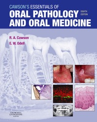 Cawson's Essentials of Oral Pathology and Oral Medicine