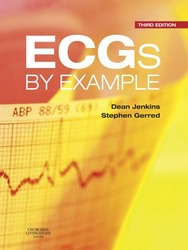 ECGs by Example E-Book