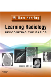 Learning Radiology: Recognizing the Basics, 2E