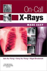 On-Call X-Rays Made Easy E-Book