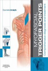 Myofascial Trigger Points