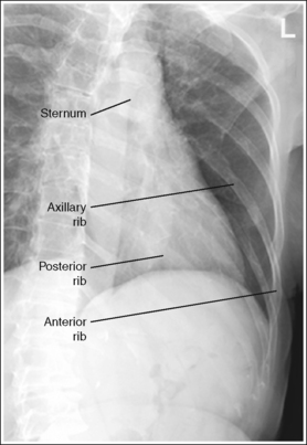 Radiographic Image Analysis