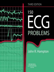 150 ECG Problems