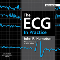 The ECG In Practice E-Book