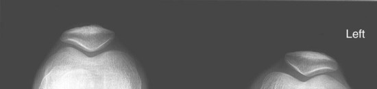 Textbook of Radiographic Positioning and Related Anatomy