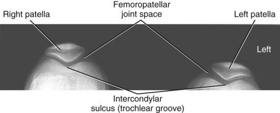 Textbook of Radiographic Positioning and Related Anatomy
