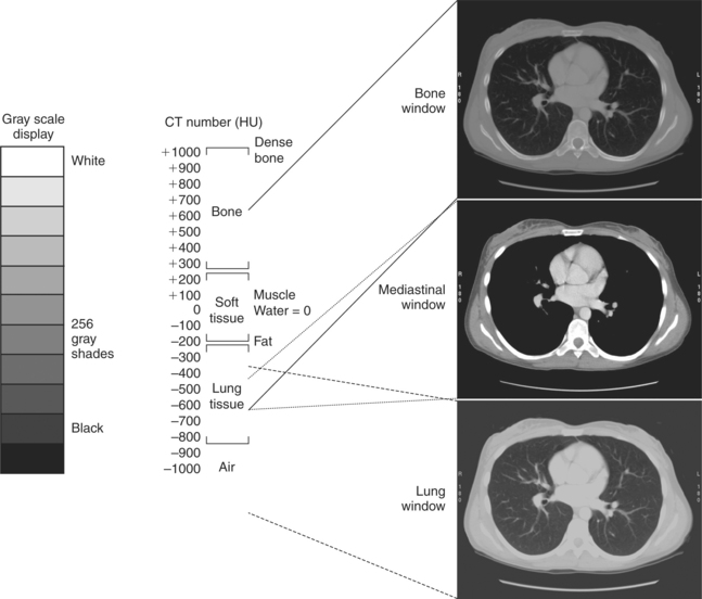 SECTIONAL ANATOMY for IMAGING PROFESSIONALS