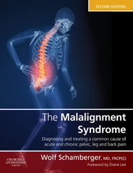 The Malalignment Syndrome: Diagnosing and treating a common cause of acute and chronic pelvic, limb and back pain