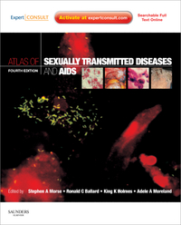 Atlas of Sexually Transmitted Diseases and AIDS