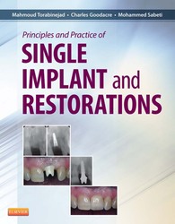 Principles and Practice of Single Implant and Restorations