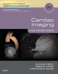 Cardiac Imaging