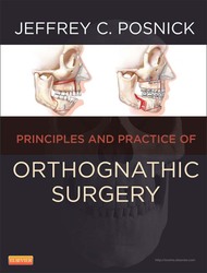 Orthognathic Surgery - 2 Volume Set, 1ed