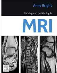 Planning and positioning in MRI