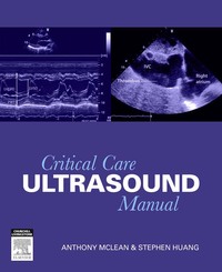 Critical Care Ultrasound Manual ebook