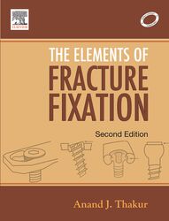 Elements of Fracture Fixation