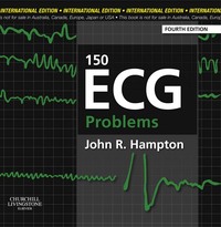 150 ECG Problems, 4ed