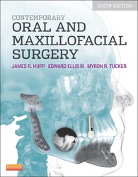 Contemporary Oral and Maxillofacial Surgery  6ed