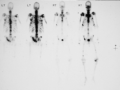 Principles and Practice of Radiation Therapy