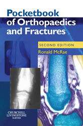 Pocketbook of Orthopaedics and Fractures