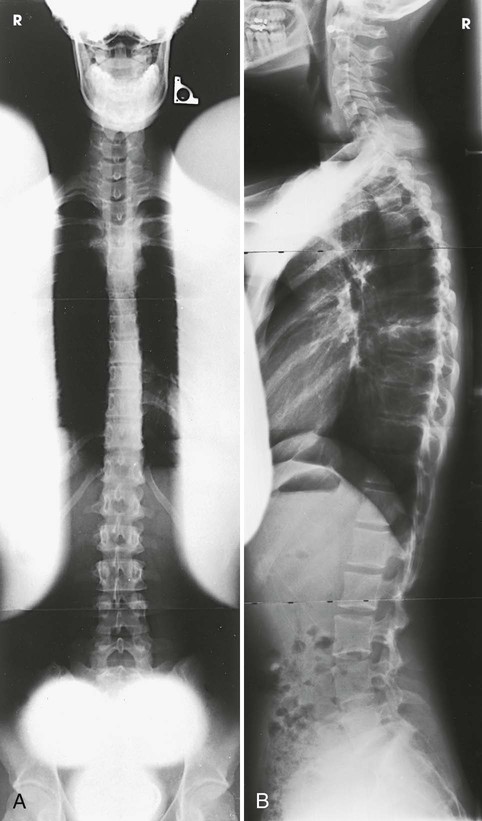 Merrill's Atlas of Radiographic Positioning & Procedures