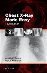 Chest X-Ray Made Easy