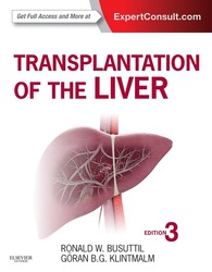 Transplantation of the Liver