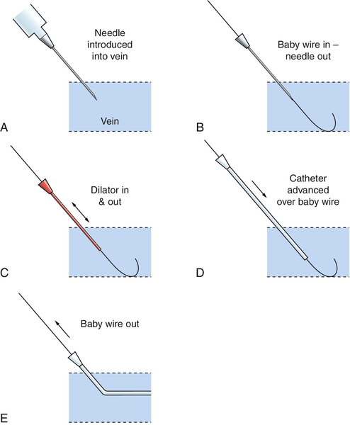 f15-02-9780323225908