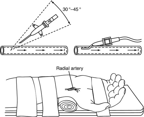 f15-03-9780323225908