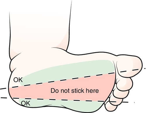 f15-04-9780323225908