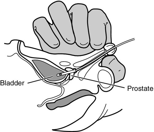 f15-05-9780323225908