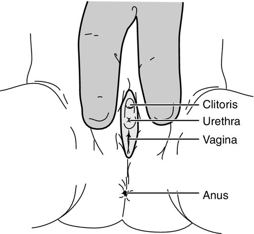 f15-06-9780323225908