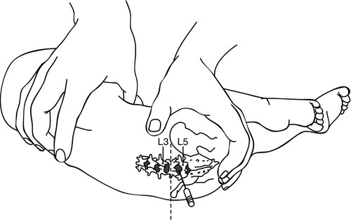 f15-07-9780323225908