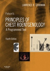 Felson's Principles of Chest Roentgenology