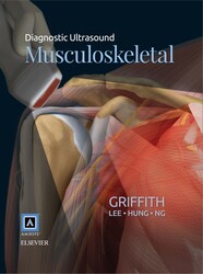 Diagnostic Ultrasound: Musculoskeletal