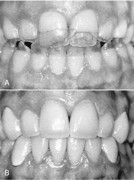 f01-01-9780323263238