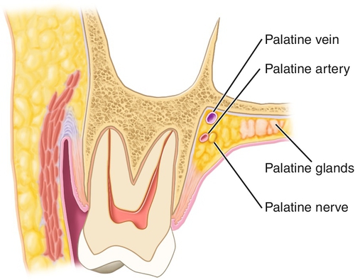 f01-06-9780323263238
