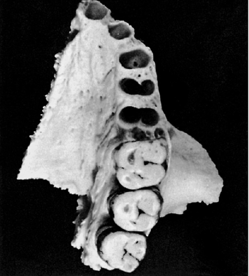 f01-07-9780323263238