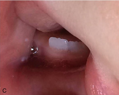 f01-10c-9780323263238