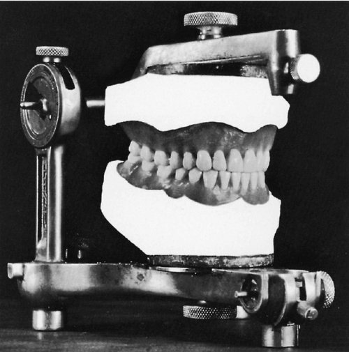 f01-16-9780323263238