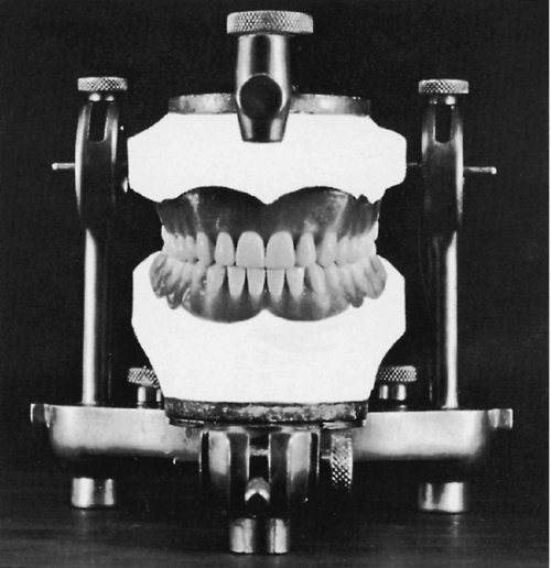 f01-17-9780323263238