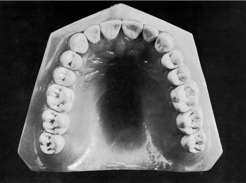 f01-18a-9780323263238