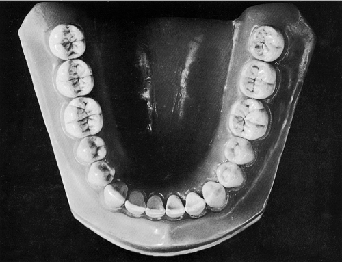 f01-18b-9780323263238