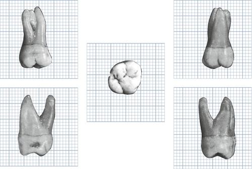 f01-20-9780323263238